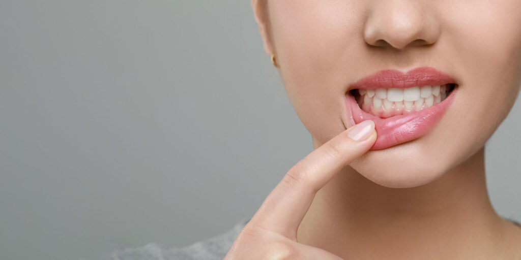 gum disease close up