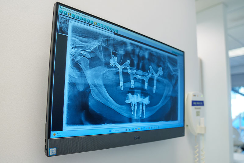 screen on wall