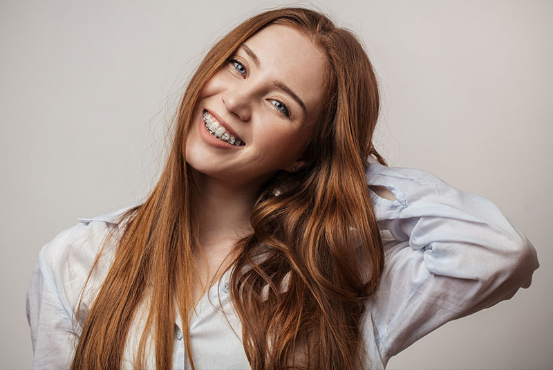 girl with clear braces